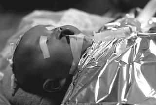 Cina, 102-037-14
Un bambino pronto per un intervento al labbro leporino, 2007
Ospedale Civile, Siyang (Cina)