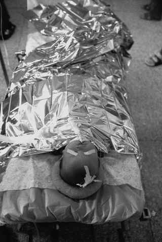 Cina, 102-038-00
Un bambino pronto per un intervento al labbro leporino, 2007
Ospedale Civile, Siyang (Cina)