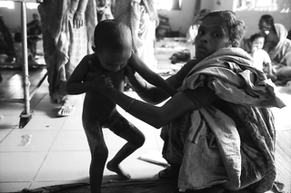 Bangladesh, 103-026-03
Donna accovacciata sorregge una bambina con ustioni , 2009
Dacca (Bangladesh)